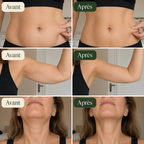 Drainage lymphatique naturel